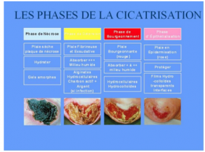 Les Pansements Complexes - ENTRAIDE ESI IDE